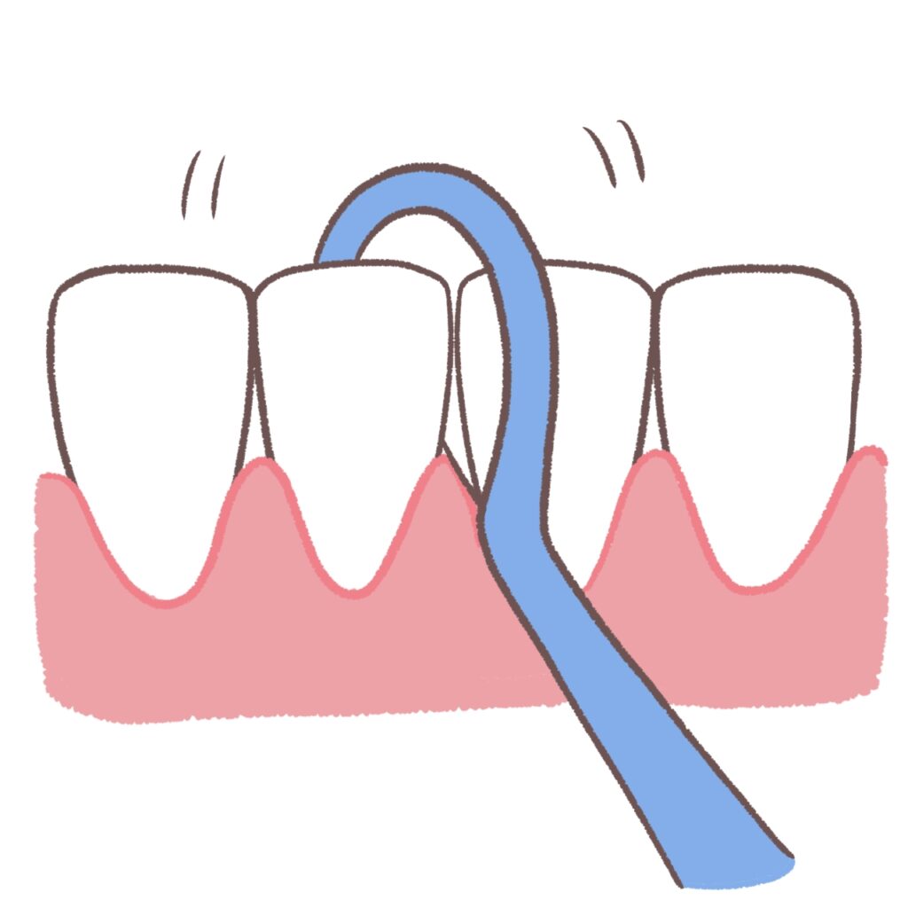 フロスをのこぎりの様に入れる図