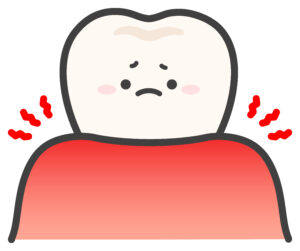 歯ぐきに炎症があるイラスト