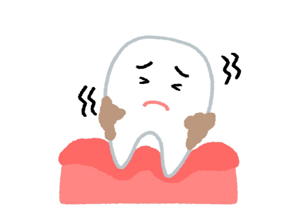 歯周病進行すると