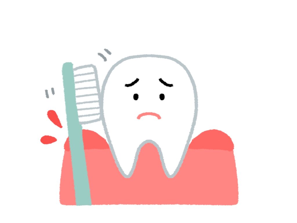 歯肉炎 赤く腫れた歯ぐき 歯ブラシで血がでた